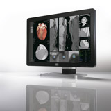 CoronisFusion6MPDL