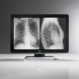 CoronisFusion6MPDL