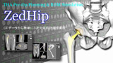 ZedHip