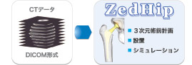 ZedHip