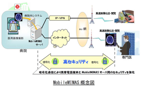 MobileMIMASTO}