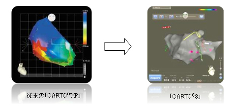ACL(Advanced Catheter Location)によるカテーテルの正確な視覚化