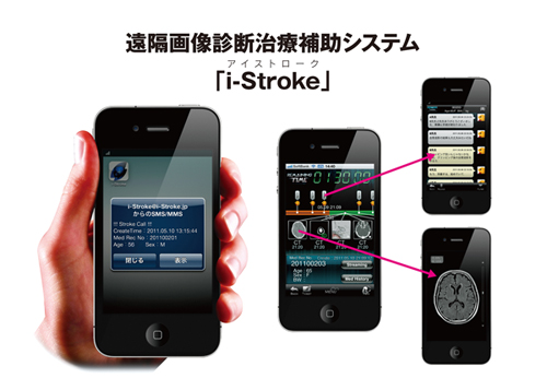 遠隔画像診断治療補助システム 「i-Stroke(アイストローク)」