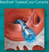 NAVISTAR THERMOCOO CATHETER