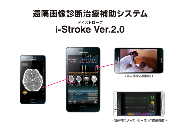 遠隔画像診断治療補助システム「i-Stroke(アイストローク) Ver.2.0」