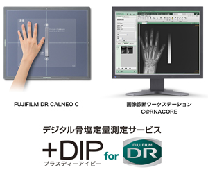 +DIP for DR