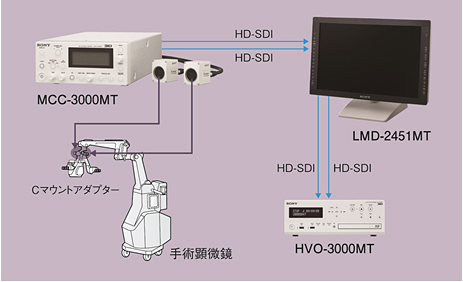 3DメディカルHDレコーダー「HVO-3000MT」の場合