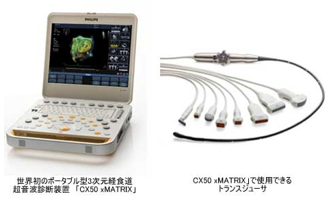 プレミアムポータブル超音波診断装置「CX50 xMATRIX(シーエックス50・エックスマトリックス)」