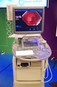 Voluson E8のHD LIve表示