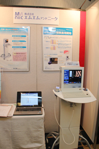 FibroScan