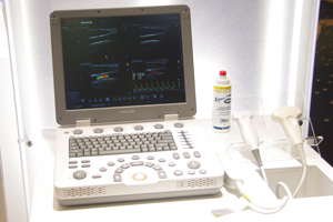 MySono U6