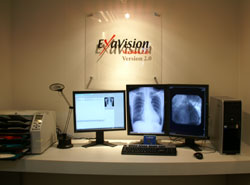 ExaVision Version2.0