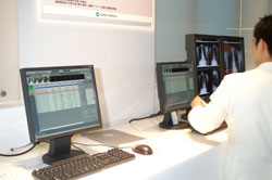 NEOVISTA I-PACS EX