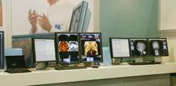 usyngo Suite JvCusyngo Imaging XSvCuXS-Reportv