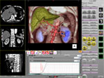 Multi Data 4 Phase Fusion