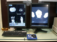 ZIOSTATION System 1000