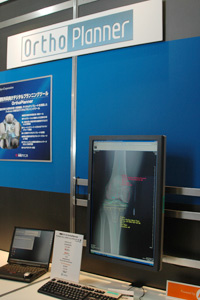 Ortho Planner