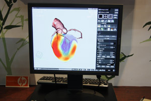 CT+SPECTt[W