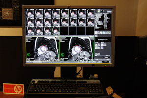 MRIS@\́iSoj