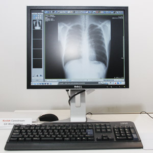 Kodak DirectView Workstation Carestream GX Workstation Software