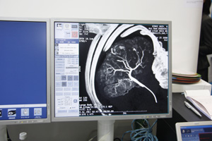 Light Speed VCT VISION Discovery CT750 HD̋ZpĂCVolume Helical ShuttleɂőŖ31cm̍L͈͂̎Be\