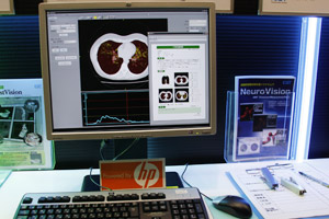 Lung Vision