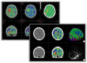 4D Brain Analysis