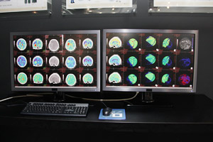 4D Brain Perfusion