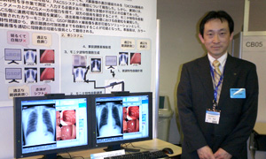 松田恵雄氏(埼玉医科大学総合医療センター)