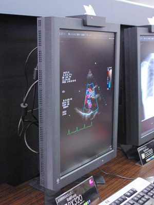 RadiForce RX320