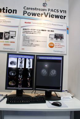 Kodak Carestream PACS V11 PowerViewer