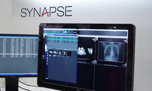 SYNAPSEのデモンストレーション