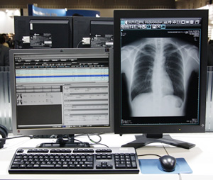 iRAD-QA
