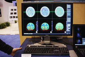 4D Brain Perfusion
