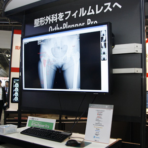Ortho Planner Pro