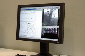 z핔VXeSYNAPSE CardioVascular
