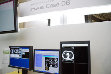 Ǘf[^x[XVXeSYAPSE Case DB