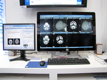 Centricity i3