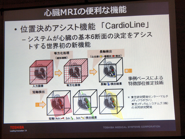 SMRICardioLine