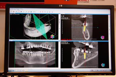 ȗpDICOMr[uDentistVision Professionalv