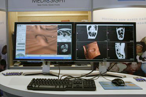 MEDICREAD 3.0 COLON