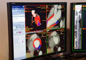 3D̐V@\Relative Perfusion