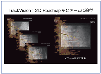 }10@ TrackVision摜CA[]ɘA