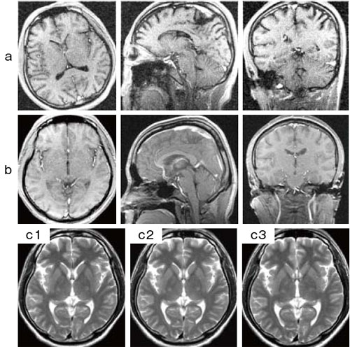 }3@Ready Brain