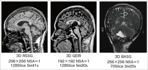 }5@Volume MRI