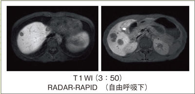 }6@RADAR-RAPIDՏ摜