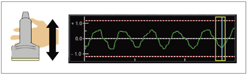 }1@Strain Graph