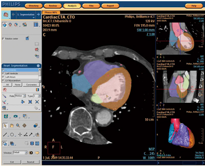 }4@Comprehensive Cardiac AnalysisiC.C.A.j