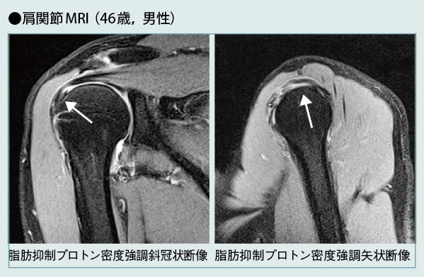 ֐MRI