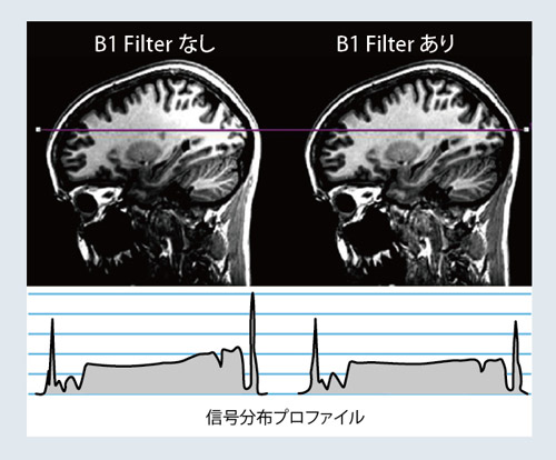 }5@B1 Filter ̌